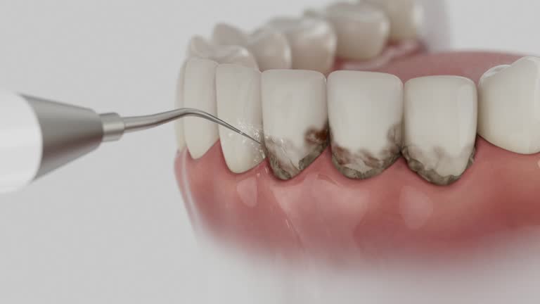 Reliable Dental contractor in Sequim, WA by Smile Center Dentistry